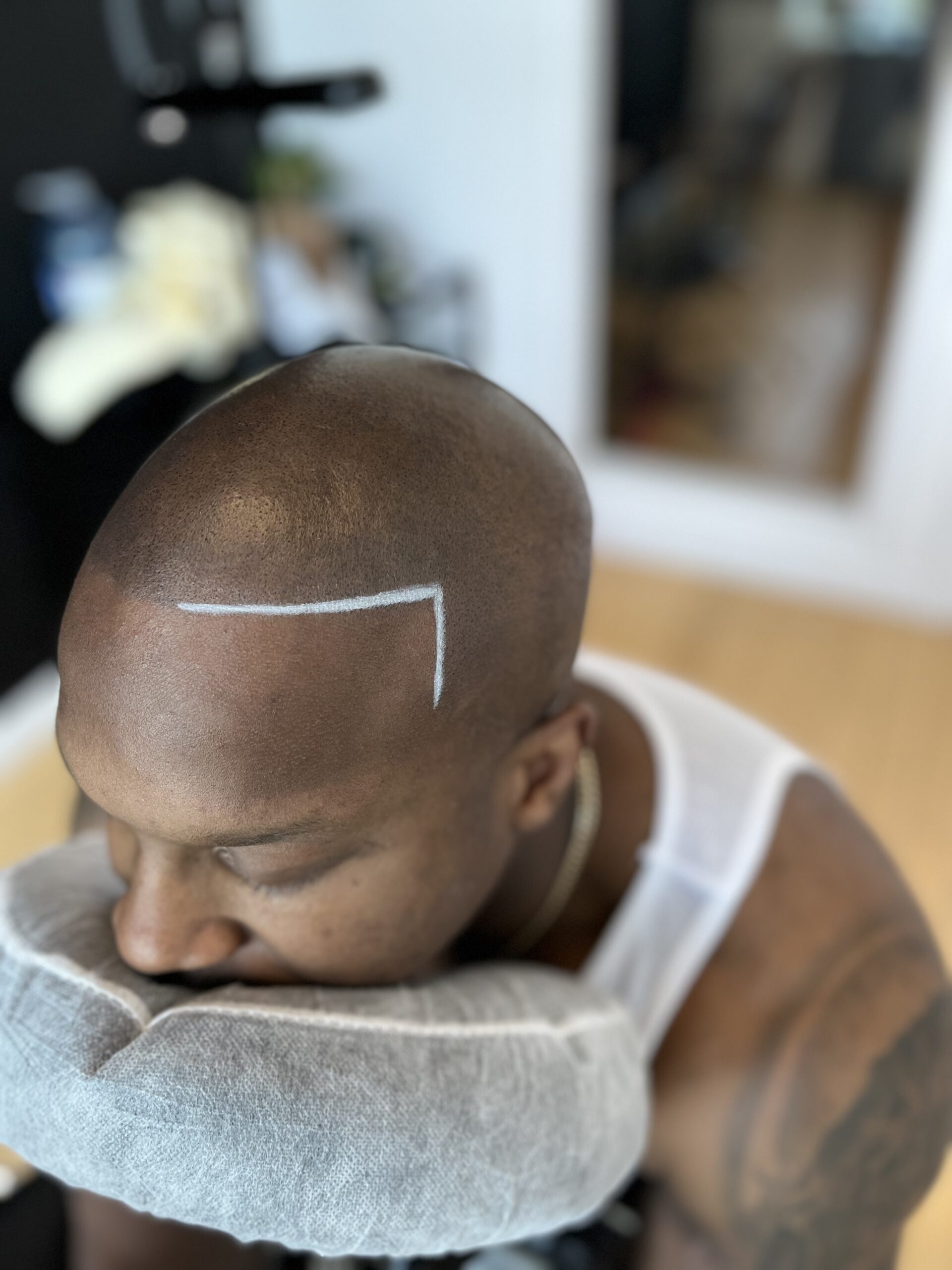 Benji performing scalp micropigmentation treatment in Pickering